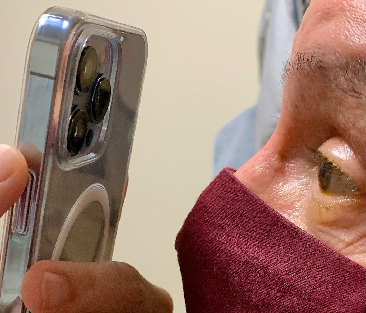 The iPhone 13 Pro's Macro Mode Is Also Helpful For Doctors